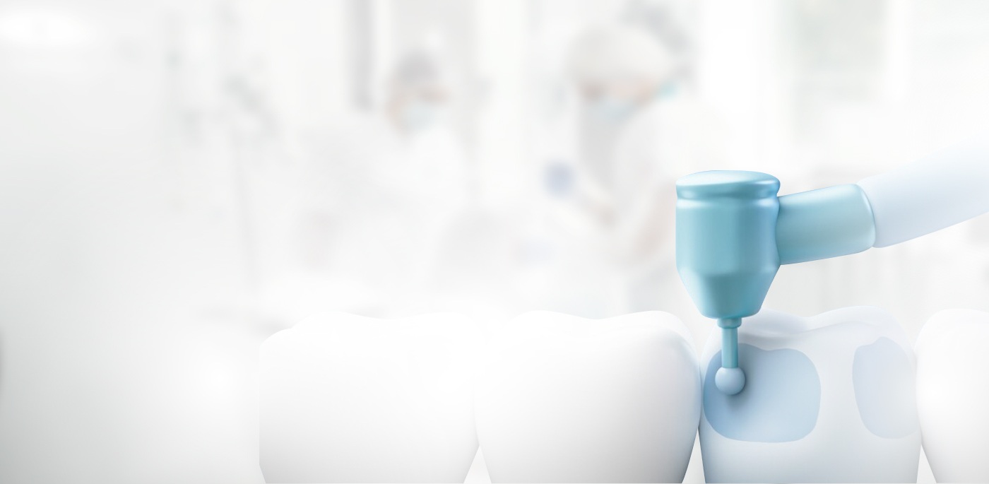 Лечение кариеса